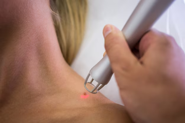Searching "Mole Removal Near Me" in London? Five Signs You're Choosing a Clinic That Prioritises Safety